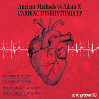 Ancient Methods - Cardiac Dysrhythmia (EP)